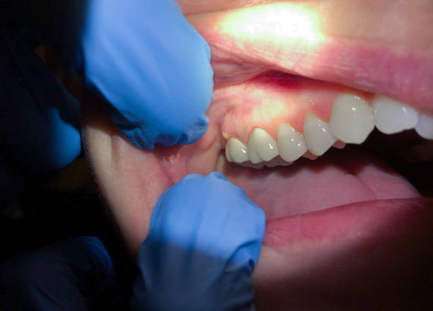 Best Emergency Treatment for Toothache in Lyndon, KS