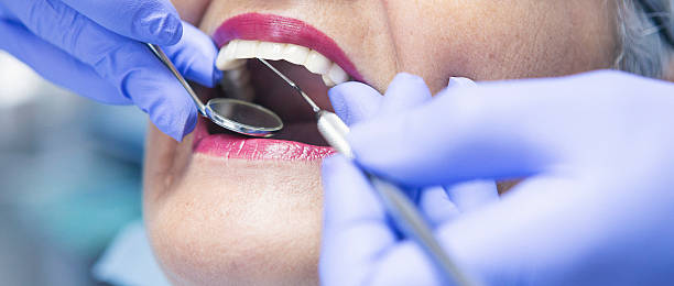 Best Emergency Tooth Extraction in Lyndon, KS